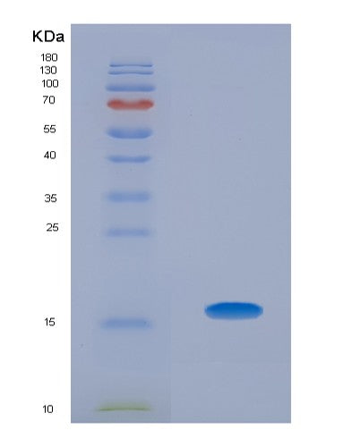 Human AHSP (Alpha-Hemoglobin-Stabilizing Protein) - Recombinant Protein
