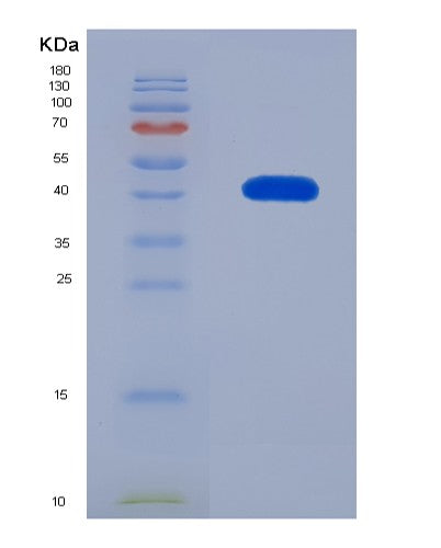 Human MAT2B (Methionine Adenosyltransferase 2 Subunit Beta) - Recombinant Protein