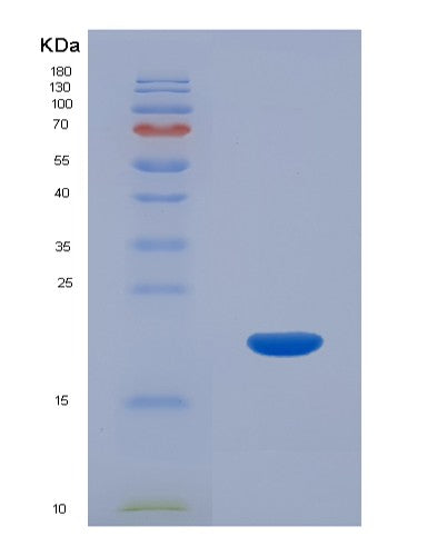 Human CALML5 (Calmodulin-Like Protein 5) - Recombinant Protein