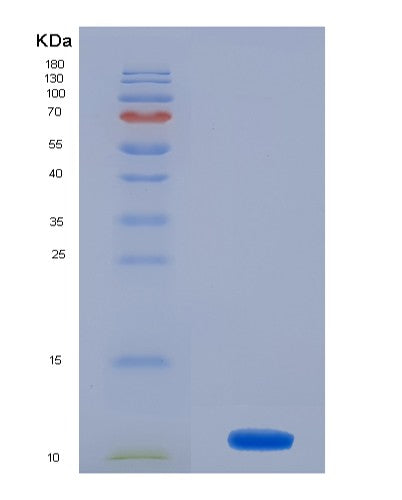 Human MSRB1 (Methionine-R-Sulfoxide Reductase B1) - Recombinant Protein