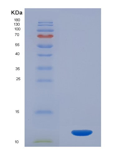 Human CLCF1 (Cardiotrophin-Like Cytokine Factor 1) - Recombinant Protein