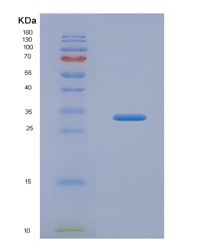 Human UPB1 (Beta-Ureidopropionase) - Recombinant Protein