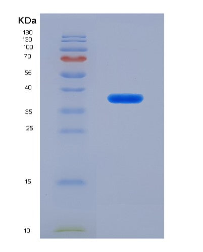 Human CTSZ (Cathepsin Z) - Recombinant Protein