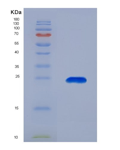 Human HSPB7 (Heat Shock Protein Beta-7) - Recombinant Protein