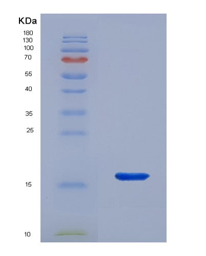 Human LAMTOR3 (Ragulator Complex Protein Lamtor3) - Recombinant Protein