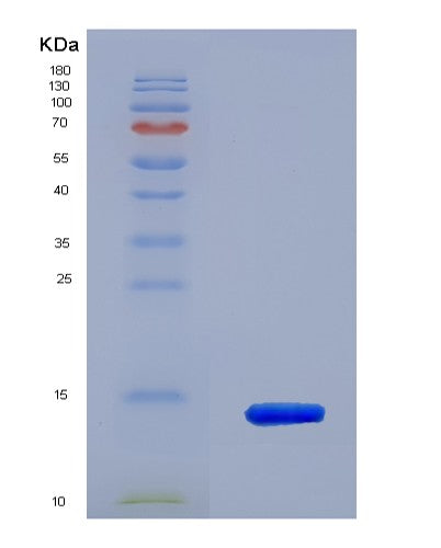 Human UBQLN2 (Ubiquilin-2) - Recombinant Protein