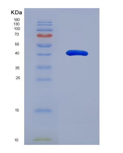 Human FKBPL (Fk506-Binding Protein-Like) - Recombinant Protein