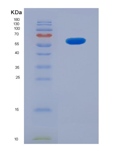 Human CD207 (C-Type Lectin Domain Family 4 Member K) - Recombinant Protein