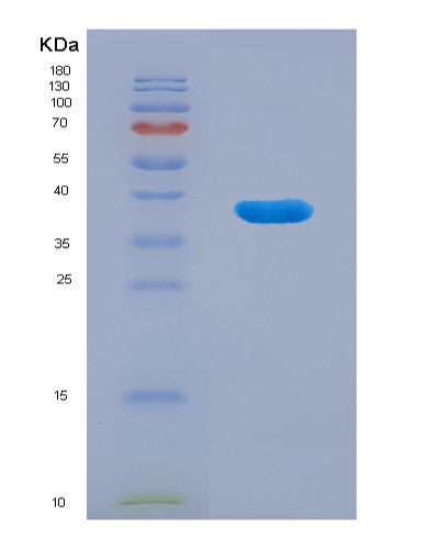 Human ANXA10 (Annexin A10) - Recombinant Protein