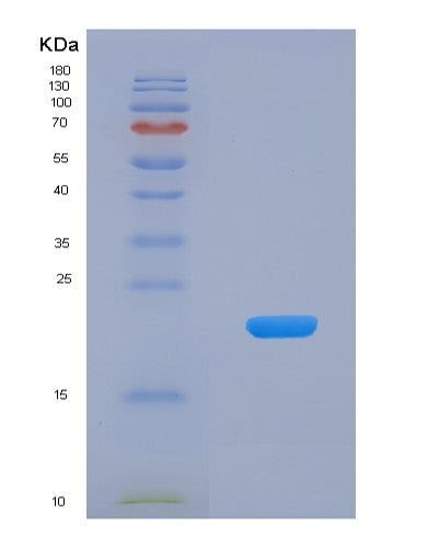 Human EGR1 (Early Growth Response Protein 1) - Recombinant Protein
