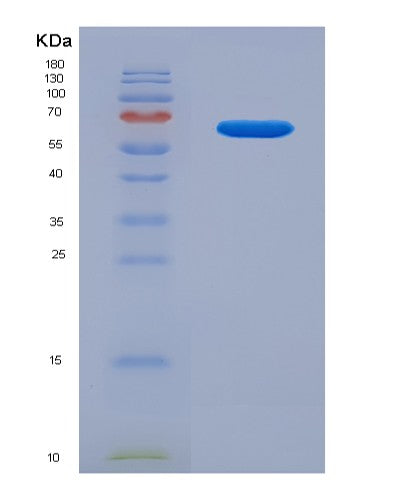 Human FBXO2 (F-Box Only Protein 2) - Recombinant Protein