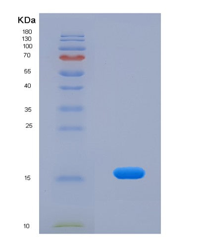 Human DBR1 (Lariat Debranching Enzyme) - Recombinant Protein