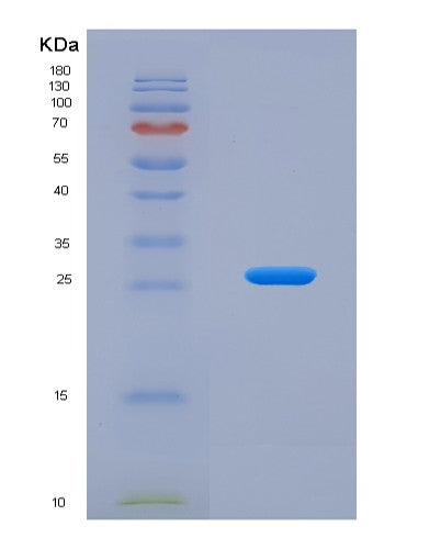 Human DNAJC12 (Dnaj Homolog Subfamily C Member 12) - Recombinant Protein