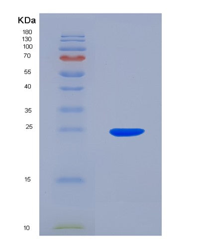 Human CADPS (Calcium-Dependent Secretion Activator 1) - Recombinant Protein