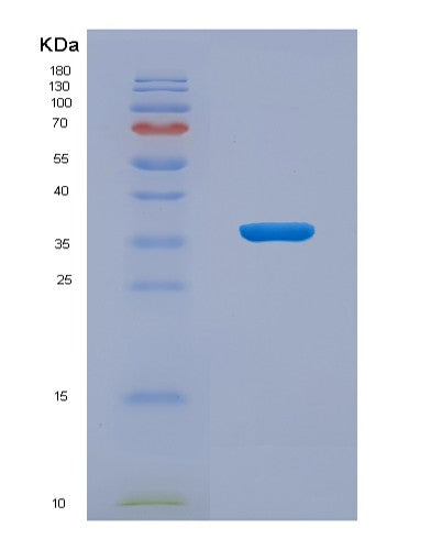 Human PADI4 (Protein-Arginine Deiminase Type-4) - Recombinant Protein