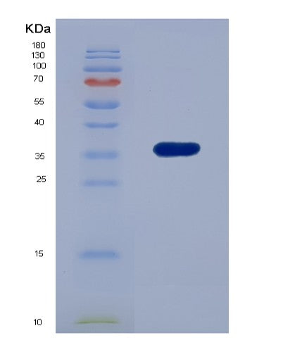 Human EDAR (Tumor Necrosis Factor Receptor Superfamily Member Edar) - Recombinant Protein