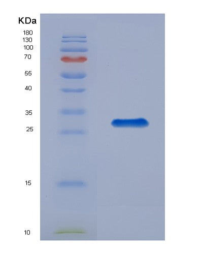 Human PPIE (Peptidyl-Prolyl Cis-Trans Isomerase E) - Recombinant Protein