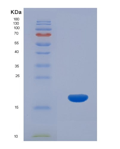 Human CCL26 (C-C Motif Chemokine 26) - Recombinant Protein