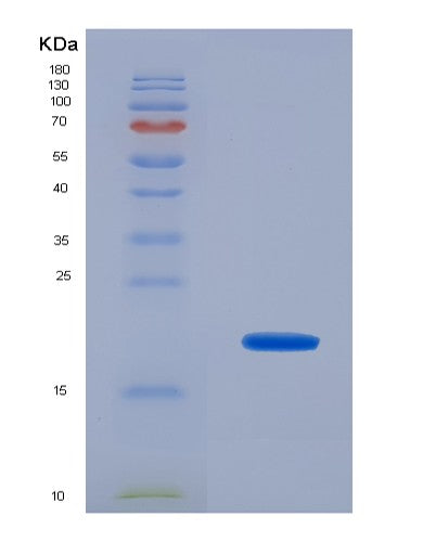 Human NUDC (Nuclear Migration Protein Nudc) - Recombinant Protein