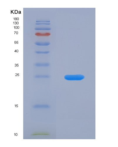 Human GDA (Guanine Deaminase) - Recombinant Protein