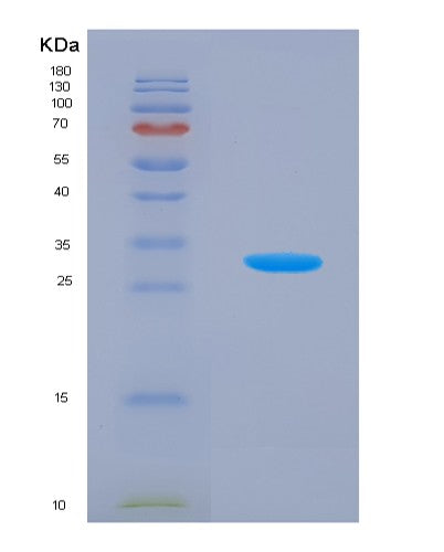 Human KLK5 (Kallikrein-5) - Recombinant Protein
