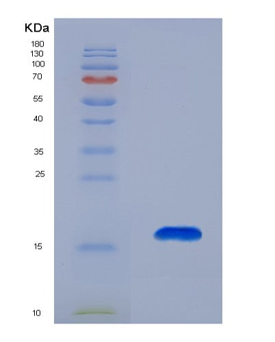 Human CCL27 (C-C Motif Chemokine 27) - Recombinant Protein