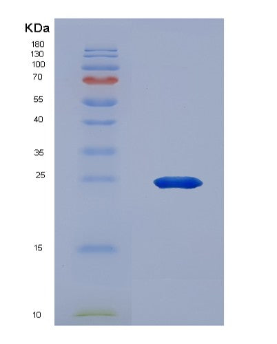 Human ANGPTL3 (Angiopoietin-Related Protein 3) - Recombinant Protein