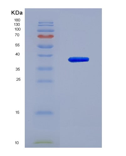 Human UCHL5 (Ubiquitin Carboxyl-Terminal Hydrolase Isozyme L5) - Recombinant Protein