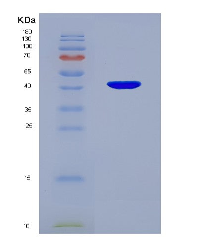 Human WIF1 (Wnt Inhibitory Factor 1) - Recombinant Protein