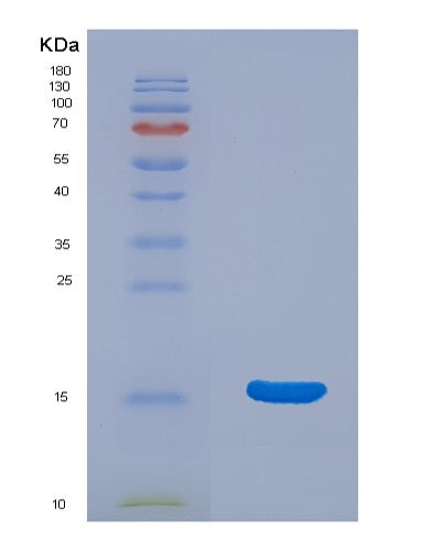 Human HCFC2 (Host Cell Factor 2) - Recombinant Protein