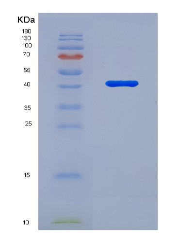 Human PSAT1 (Phosphoserine Aminotransferase) - Recombinant Protein