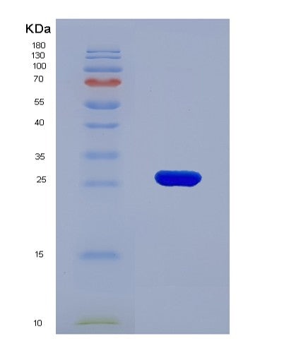 Human F11R (Junctional Adhesion Molecule A) - Recombinant Protein