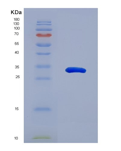 Human SPIN1 (Spindlin-1) - Recombinant Protein
