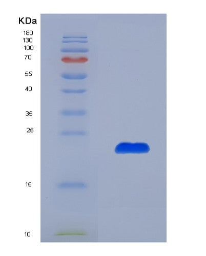 Human CLIC4 (Chloride Intracellular Channel Protein 4) - Recombinant Protein
