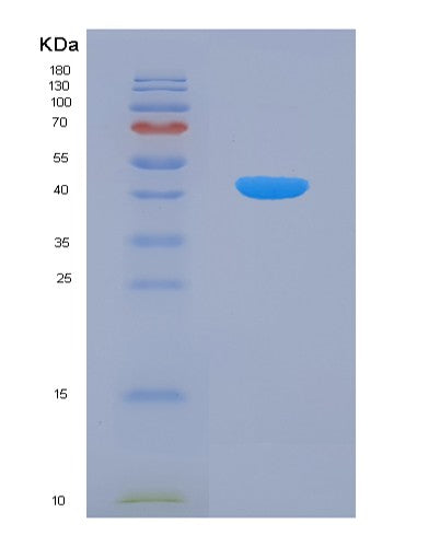 Human TNFSF13B (Tumor Necrosis Factor Ligand Superfamily Member 13B) - Recombinant Protein