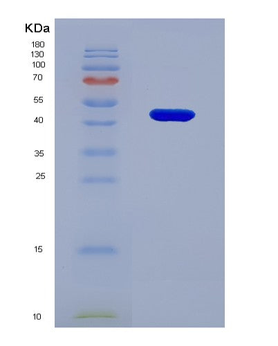 Human CD276 (Cd276 Antigen) - Recombinant Protein