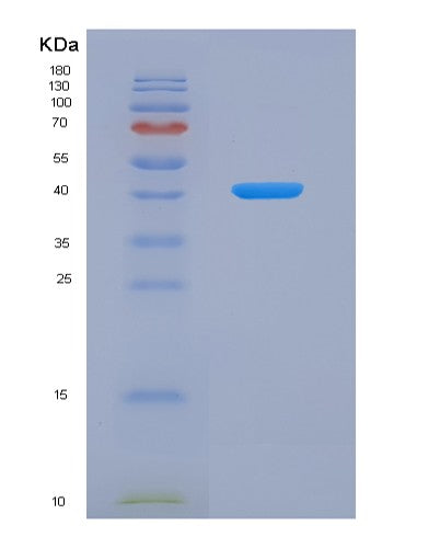 Human AZGP1 (Zinc-Alpha-2-Glycoprotein) - Recombinant Protein