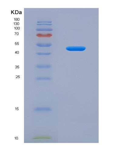 Human DKK3 (Dickkopf-Related Protein 3) - Recombinant Protein