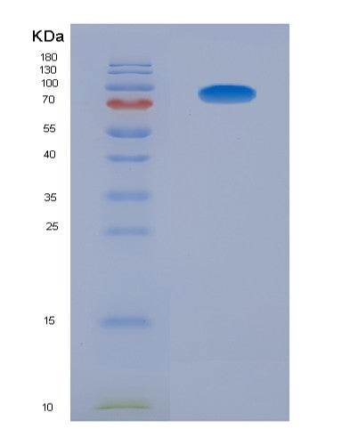 Human AGER (Advanced Glycosylation End Product-Specific Receptor) - Recombinant Protein