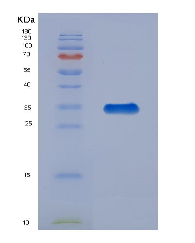Human IGFBP4 (Insulin-Like Growth Factor-Binding Protein 4) - Recombinant Protein