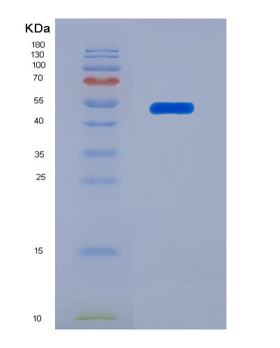 Human LTBR (Tumor Necrosis Factor Receptor Superfamily Member 3) - Recombinant Protein