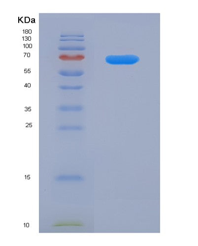 Human CX3CL1 (Fractalkine) - Recombinant Protein