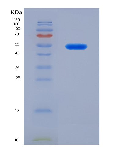 Human IL1R1 (Interleukin-1 Receptor Type 1) - Recombinant Protein