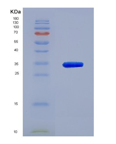 Human CD48 (Cd48 Antigen) - Recombinant Protein