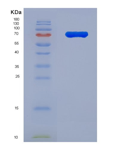 Human IL1RL2 (Interleukin-1 Receptor-Like 2) - Recombinant Protein