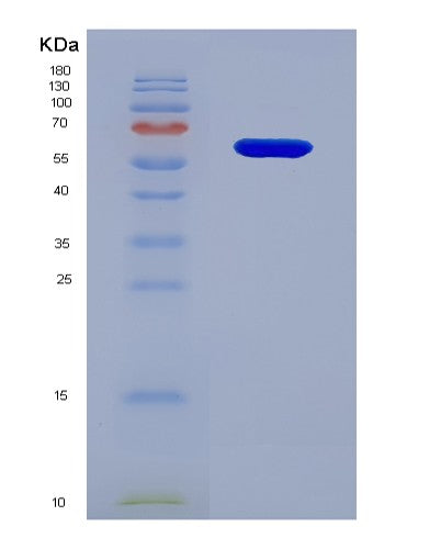 Human IL20RB (Interleukin-20 Receptor Subunit Beta) - Recombinant Protein