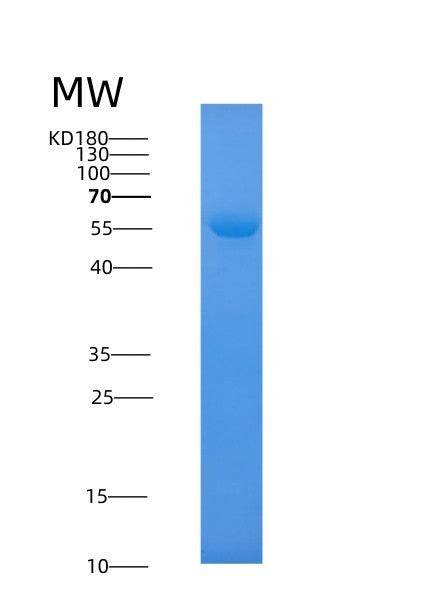 Human SHMT1 (Serine Hydroxymethyltransferase, Cytosolic) - Recombinant Protein