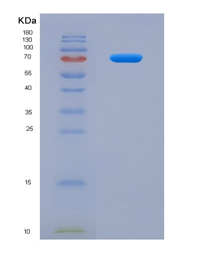 Human SLC3A2 (Amino Acid Transporter Heavy Chain Slc3A2) - Recombinant Protein