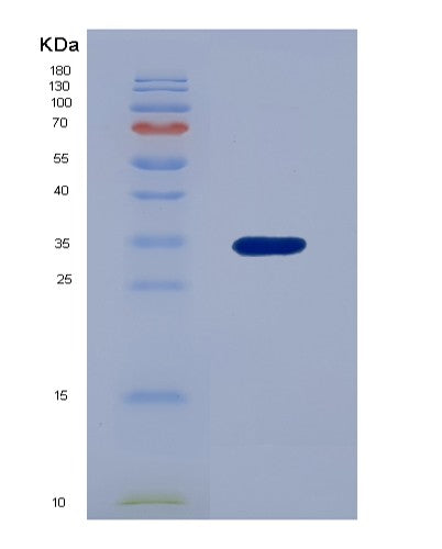 Human FOLR1 (Folate Receptor Alpha) - Recombinant Protein