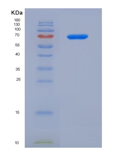 Human GDNF (Glial Cell Line-Derived Neurotrophic Factor) - Recombinant Protein